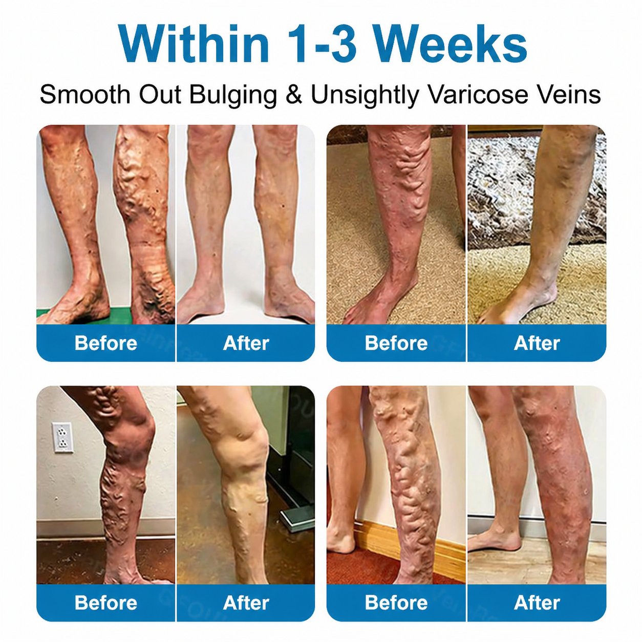 Virexo™ VeinRepair Microneedle Patch Roll⚡Instant Relief, Long-Term Results